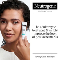 Neutrogena Evenly Clear Retinoid Adapalene Gel 0.1% Acne Spot Treatment, Once-Daily Topical Retinoid Helps Clear Breakouts & Visible Improvement in the Appearance of Post-Acne Mark, 0.5 oz