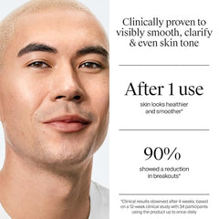 Neutrogena Evenly Clear Acne Exfoliant with Salicylic Acid & Mandelic Acid, Multi-Acid Face Exfoliating Treatment Serum Visibly Fade the look of Post-Acne Marks for A Smooth, Even Skin Tone, 1 fl. oz
