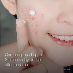 Neutrogena Rapid Clear Stubborn Acne Spot Treatment Gel with Maximum Strength 10% Benzoyl Peroxide Acne Treatment Medication, Pimple Cream for Acne Prone Skin Care, 1 oz, 2 Pack