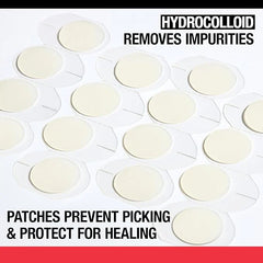 Neutrogena Stubborn Acne Ultra-Thin Patches for Acne-Prone Skin - Hydrocolloid Overnight Blemish Patch for Clear Skin, 24 Patches