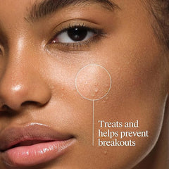 Neutrogena Oil-Free Acne Face Wash, Fragrance Free, Sensitive Skin Facial Cleanser with 2% Salicylic Acid Acne Treatment for Face, 9.1 Fl Oz,(Pack of 2)